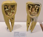 歯の博物館